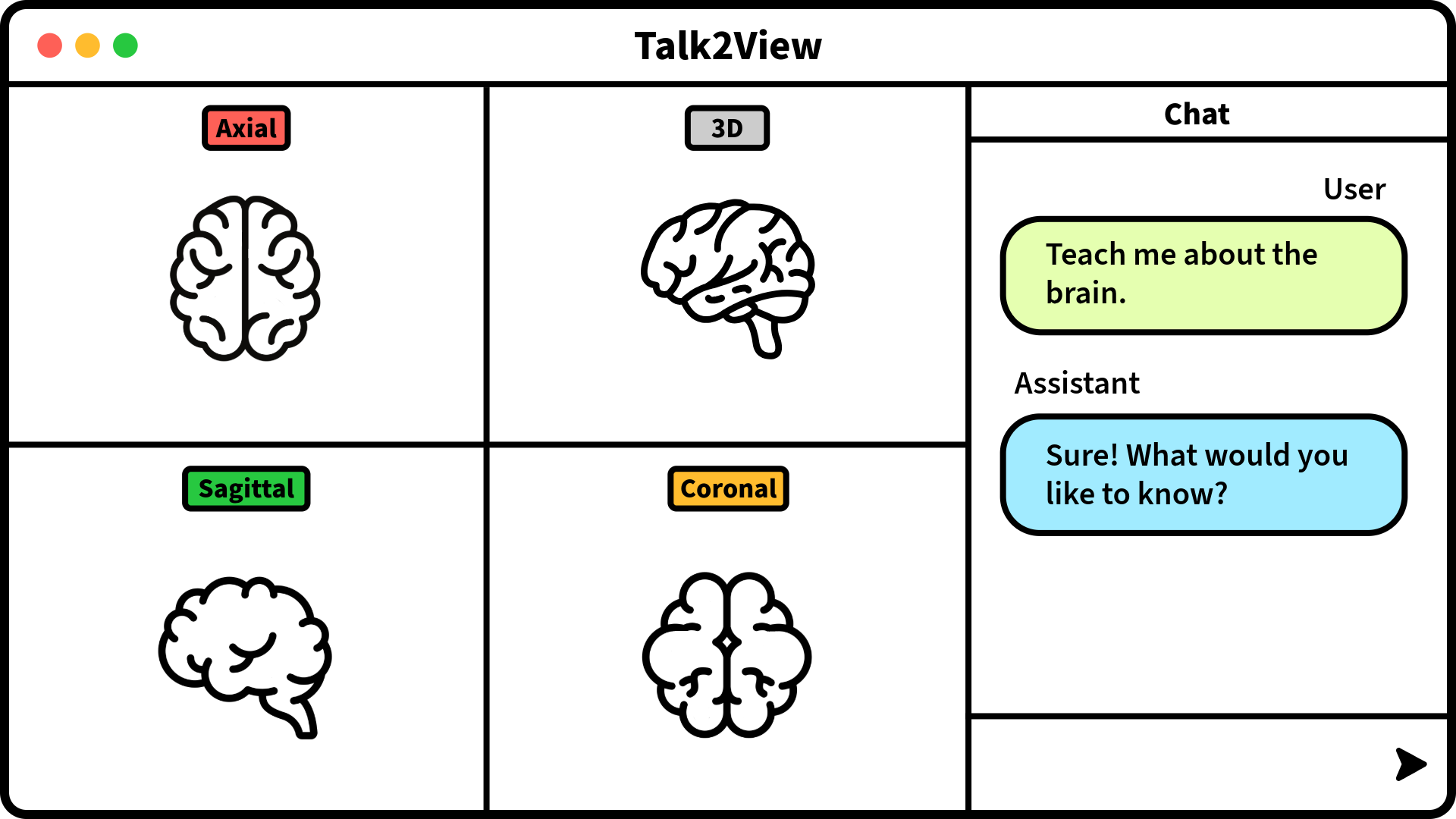 Talk2View interface showing brain scans from different angles with chat interaction